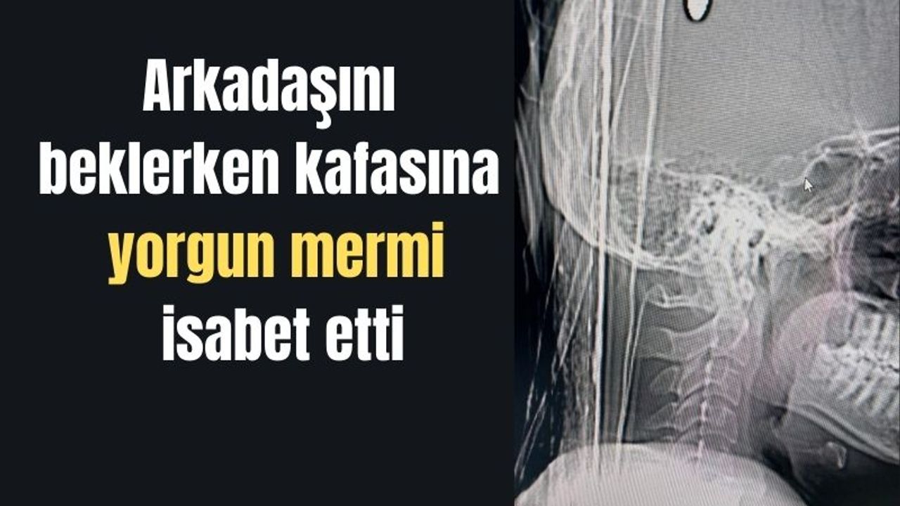 Samsun'da talihsiz olay: Arkadaşını beklerken kafasına yorgun mermi isabet etti