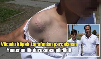 Vücudu köpek tarafından parçalanan Yunus: 'Adaletin yerini bulmasını istiyorum'