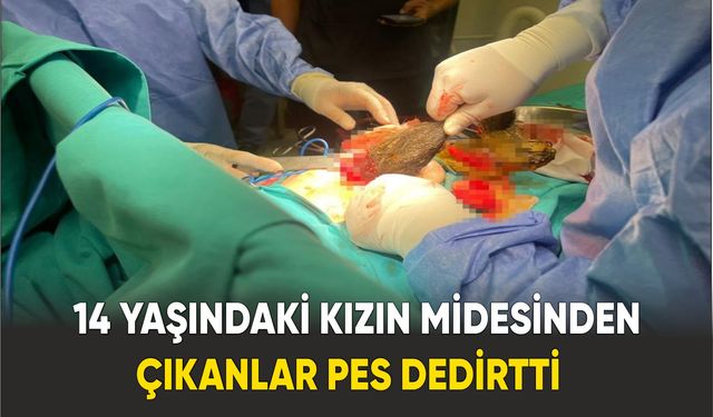 14 yaşındaki kızın midesinden çıkanlar şaşırttı