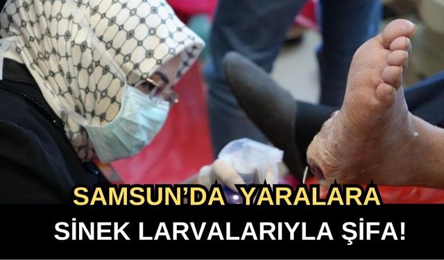 Samsun’da Larva Tedavisiyle Ameliyata Alternatif Şifa