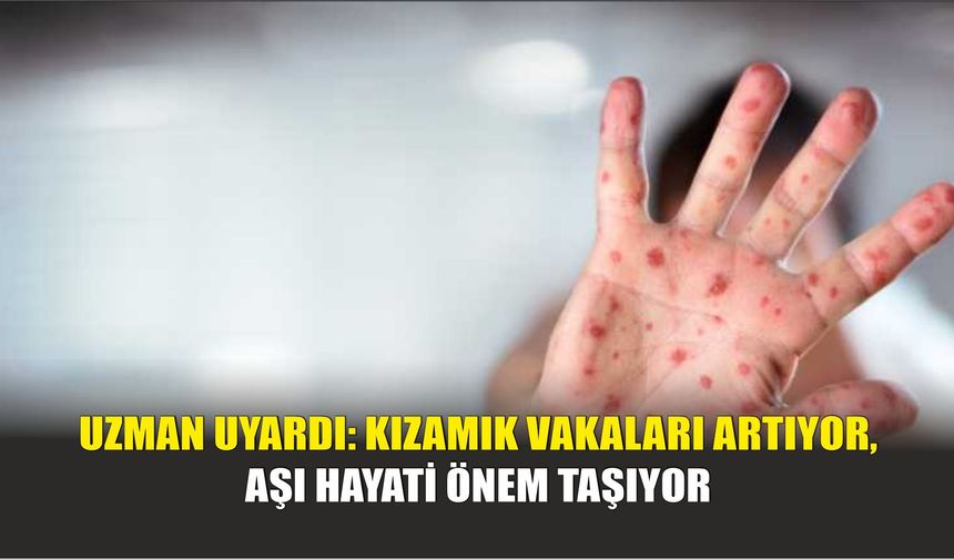 Uzman Uyardı: Kızamık Vakaları Artıyor, Aşı Hayati Önem Taşıyor