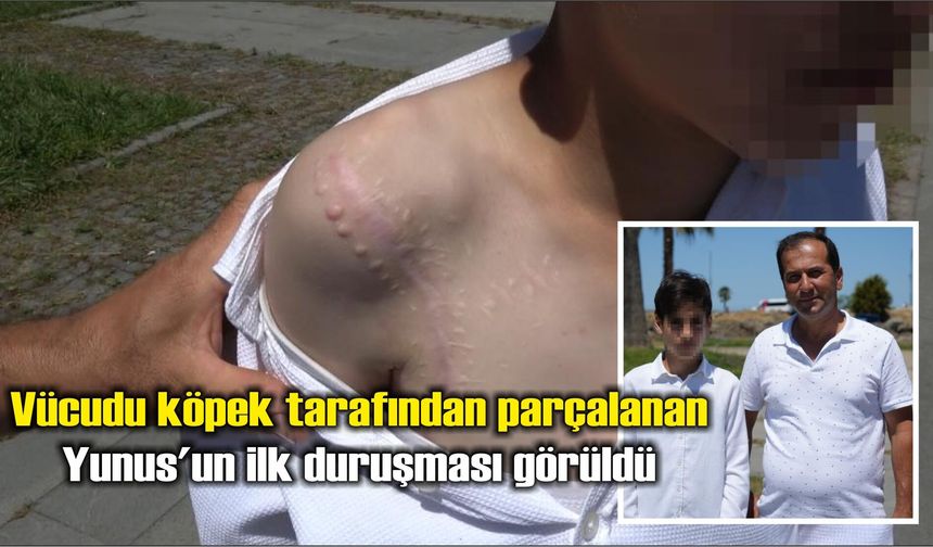 Vücudu köpek tarafından parçalanan Yunus: 'Adaletin yerini bulmasını istiyorum'