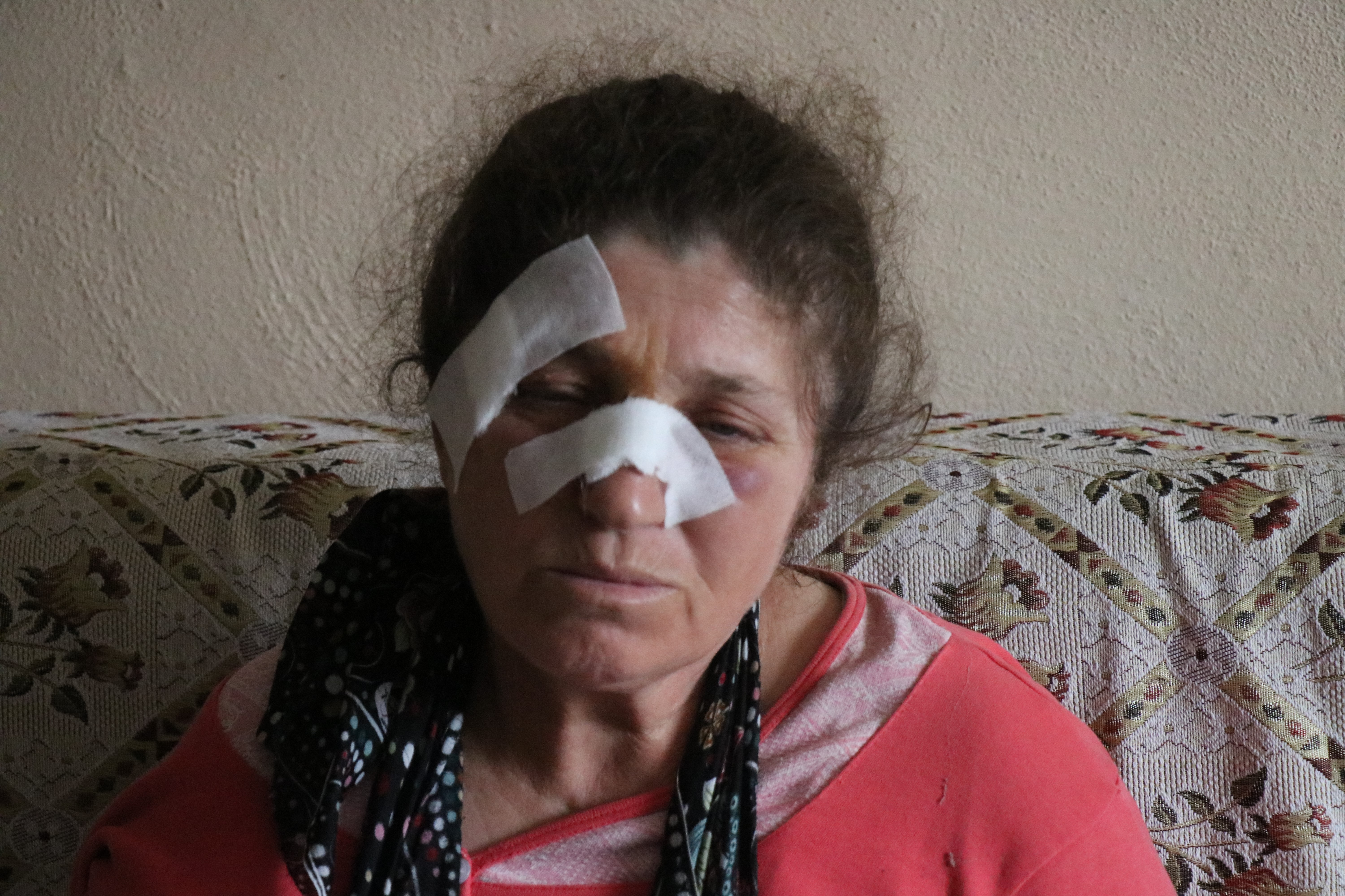 Bolu'da 4 çocuk annesi acımasızca darp edildi
