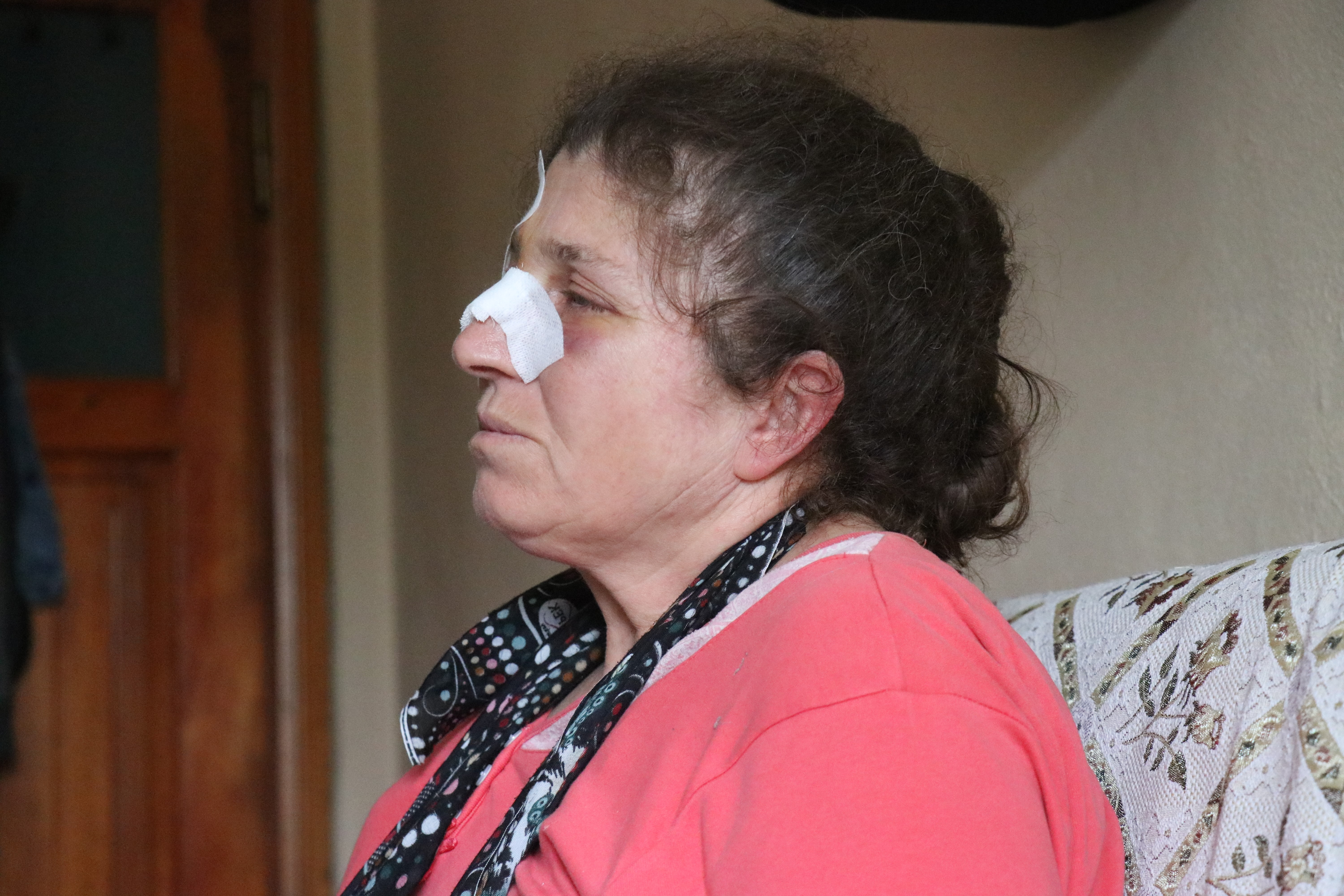 Bolu'da 4 çocuk annesi acımasızca darp edildi