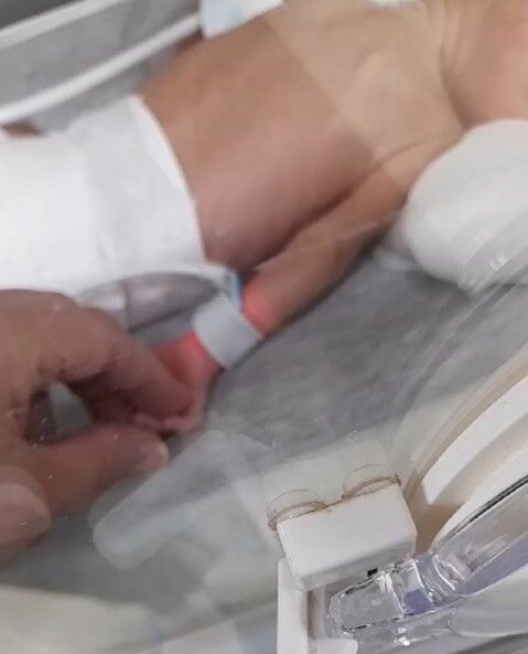 Hastanede doğan dördüz bebekler iddiaya göre kuvözde yandı, mikrop kaparak üçü öldü