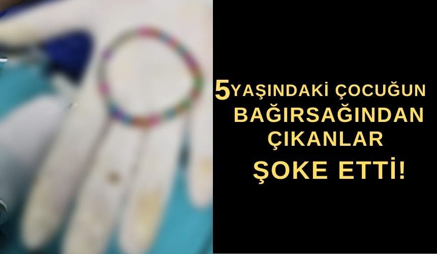 5 Yaşındaki Çocuğun Bağırsağından Çıkanlar Şoke Etti! (3)