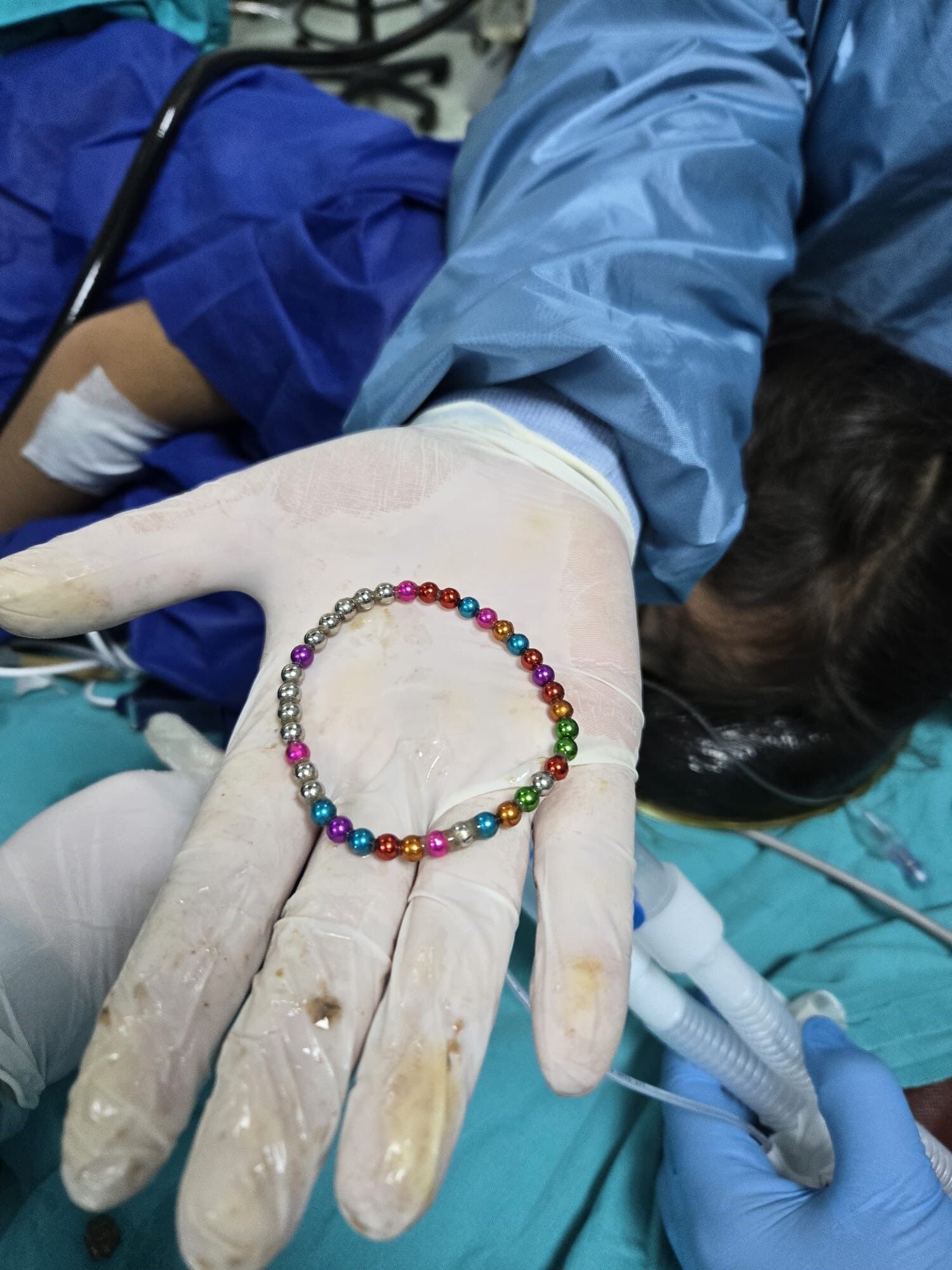 5 Yaşındaki Çocuğun Bağırsağından Çıkanlar Şoke Etti! (5)