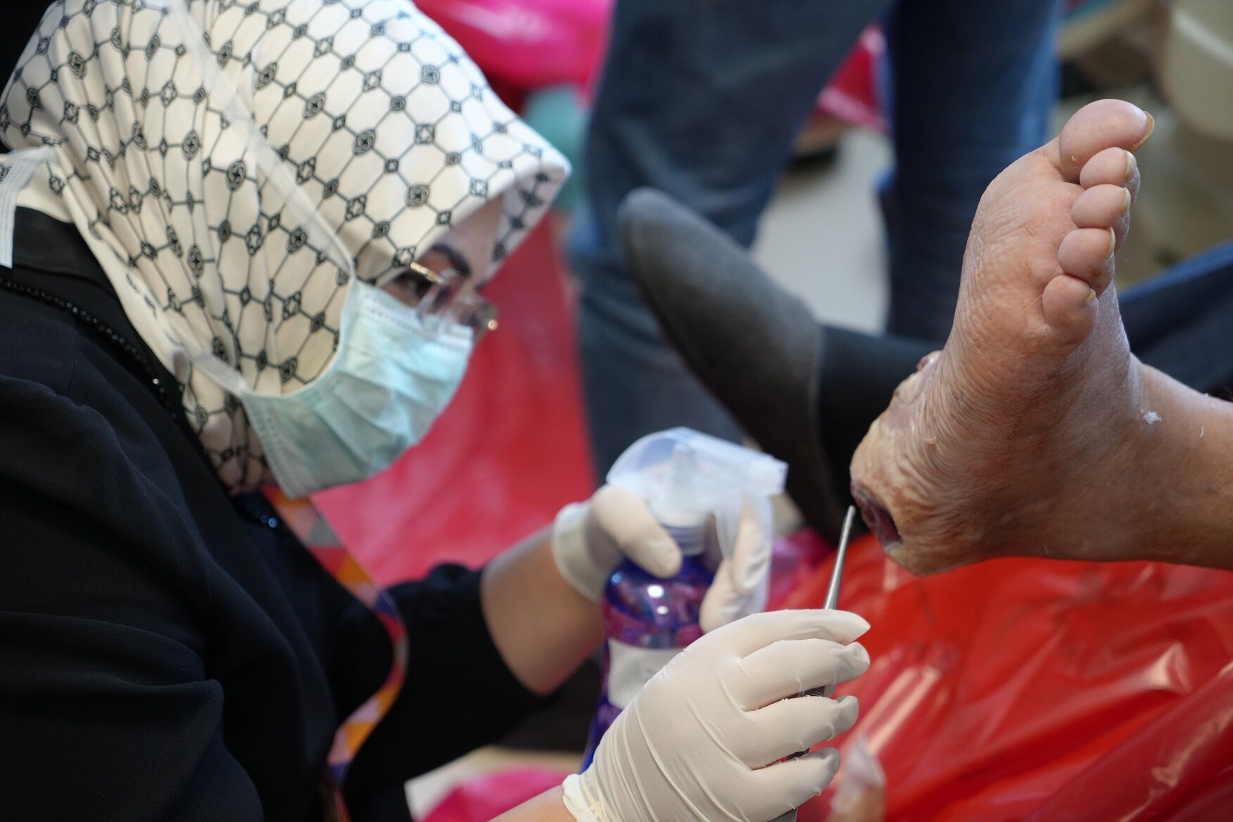 Samsun’da Larva Tedavisiyle Ameliyata Alternatif Şifa (2)