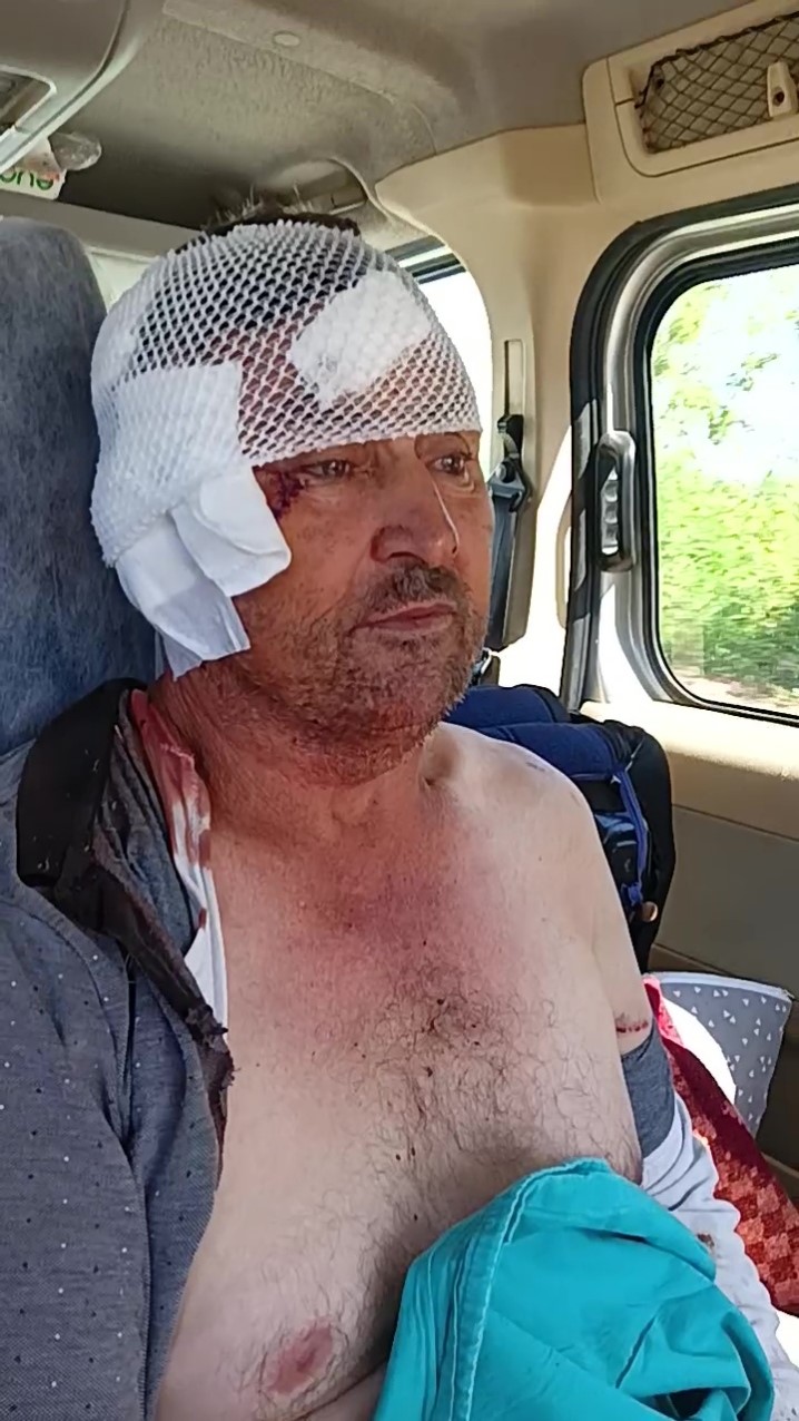 Aslanın Saldırısına Uğrayan Çiftçi O Anları Anlattı (2)