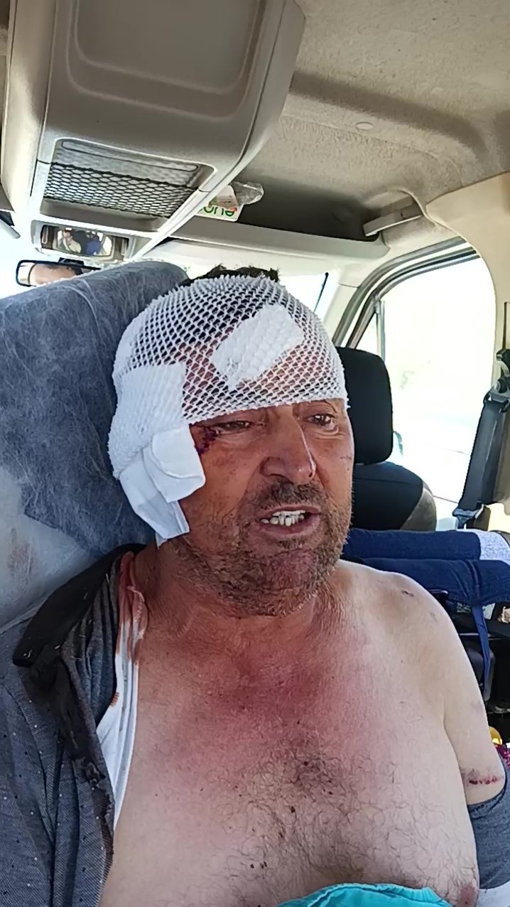 Aslanın Saldırısına Uğrayan Çiftçi O Anları Anlattı (4)
