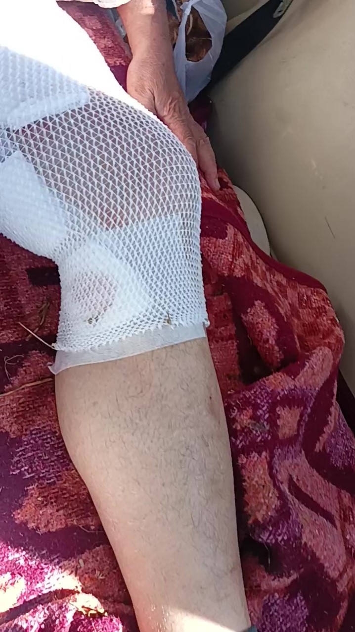 Aslanın Saldırısına Uğrayan Çiftçi O Anları Anlattı (5)