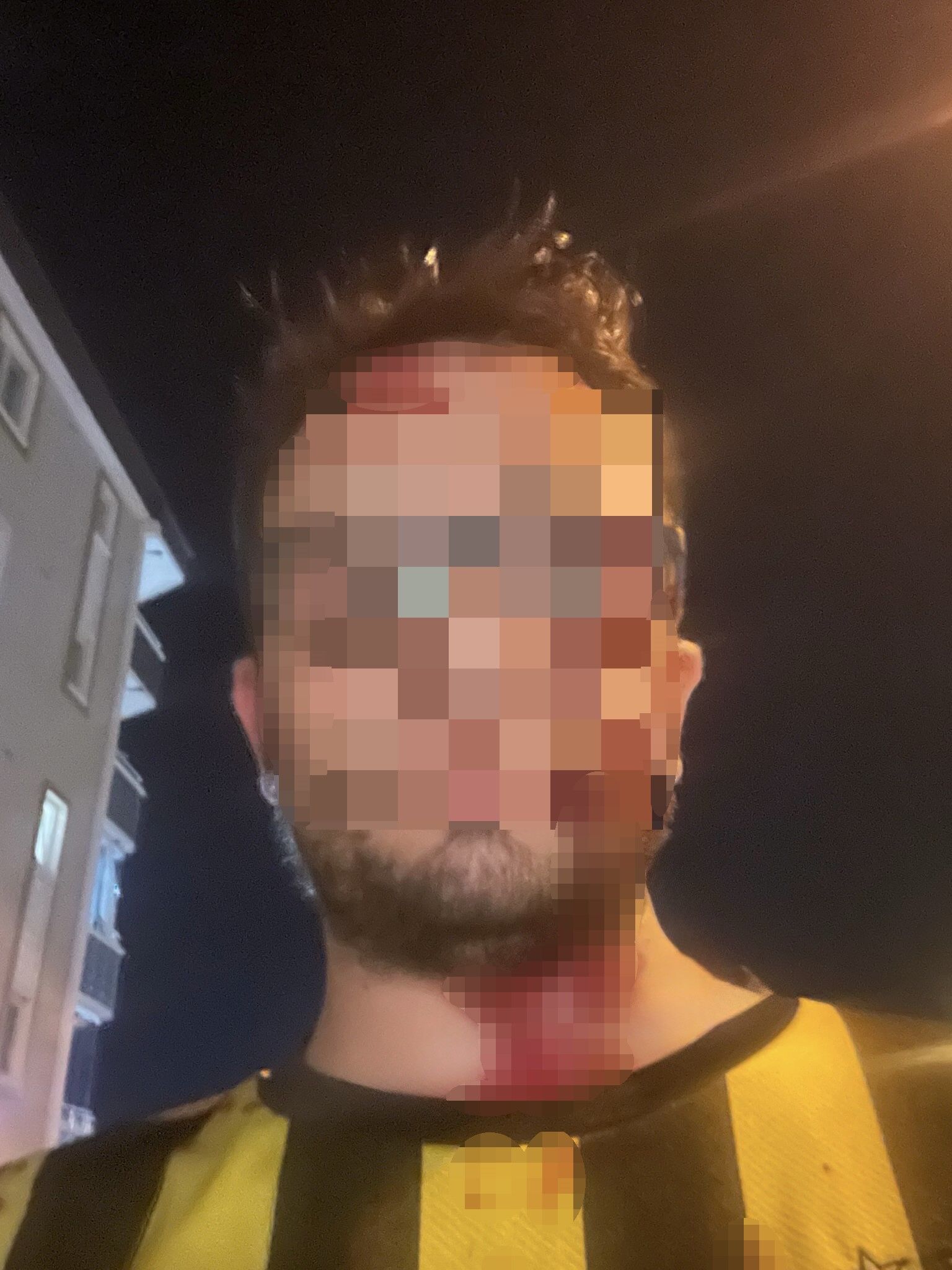 Samsun'da Daire Satışı Nedeniyle Çıkan Tekme Ve Sopalı Kavga Güvenlik Kamerasında (1)