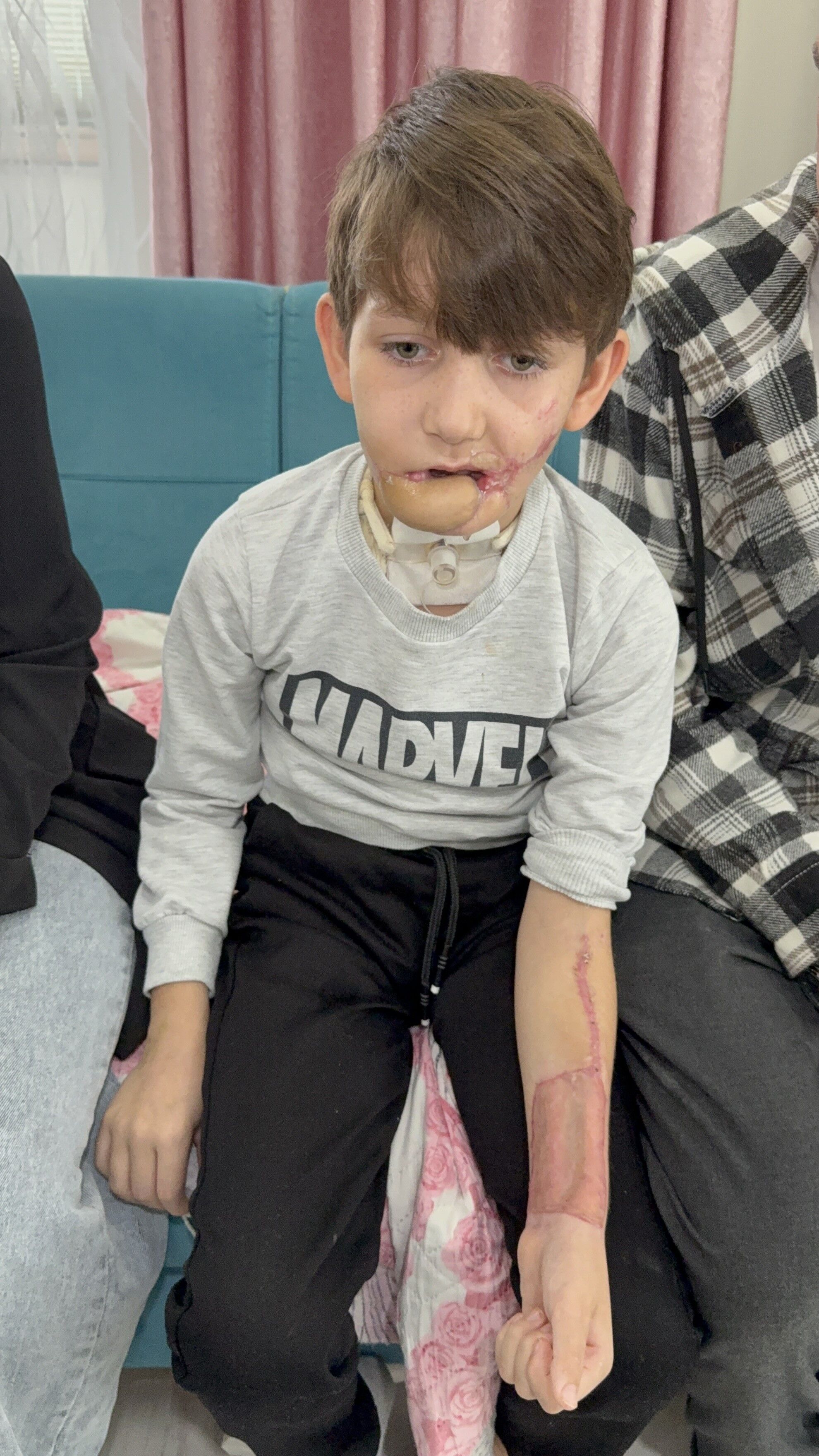 Tekkeköy'de 10 Yaşındaki Çocuk Tüfekle Çenesinden Vuruldu, Aile Adalet Arıyor (3)