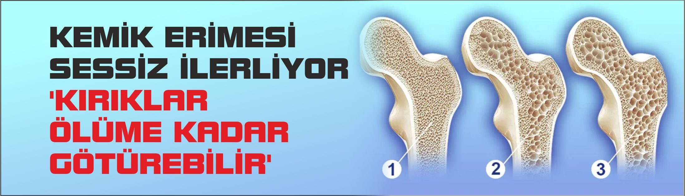 Kemik erimesi sessiz ilerliyor: 'Kırıklar ölüme kadar götürebilir'