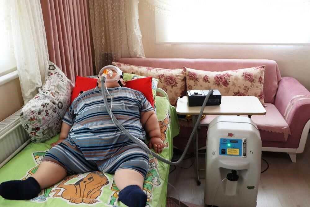 Yağız'ın Inanılmaz Değişimi 5 Yaşında 90 Kiloydu, 11 Yaşında 40 Kilo (2)