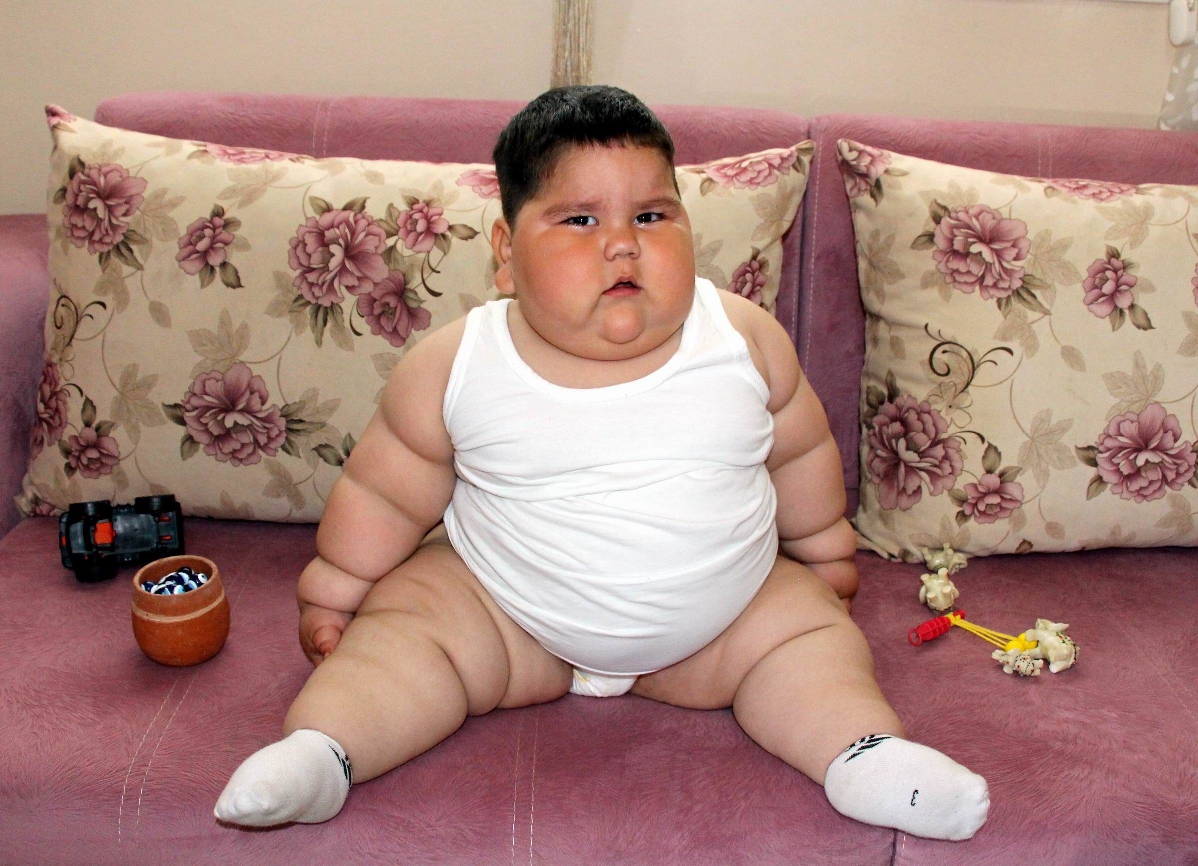 Yağız'ın Inanılmaz Değişimi 5 Yaşında 90 Kiloydu, 11 Yaşında 40 Kilo (4)