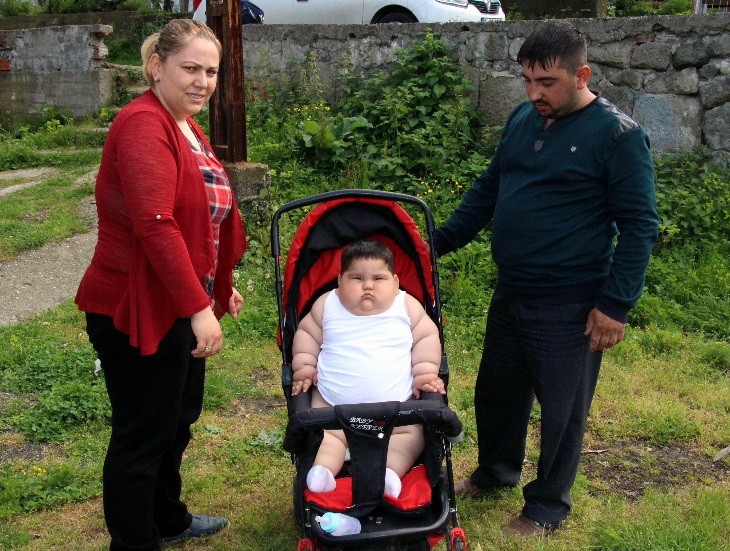 Yağız'ın Inanılmaz Değişimi 5 Yaşında 90 Kiloydu, 11 Yaşında 40 Kilo (5)