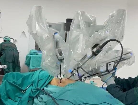 Karadeniz'de Ilk Robot Yardımlı Akciğer Kanseri Ameliyatı Gerçekleştirildi (2)